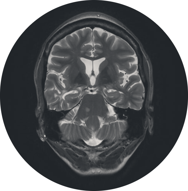 Brain MRI