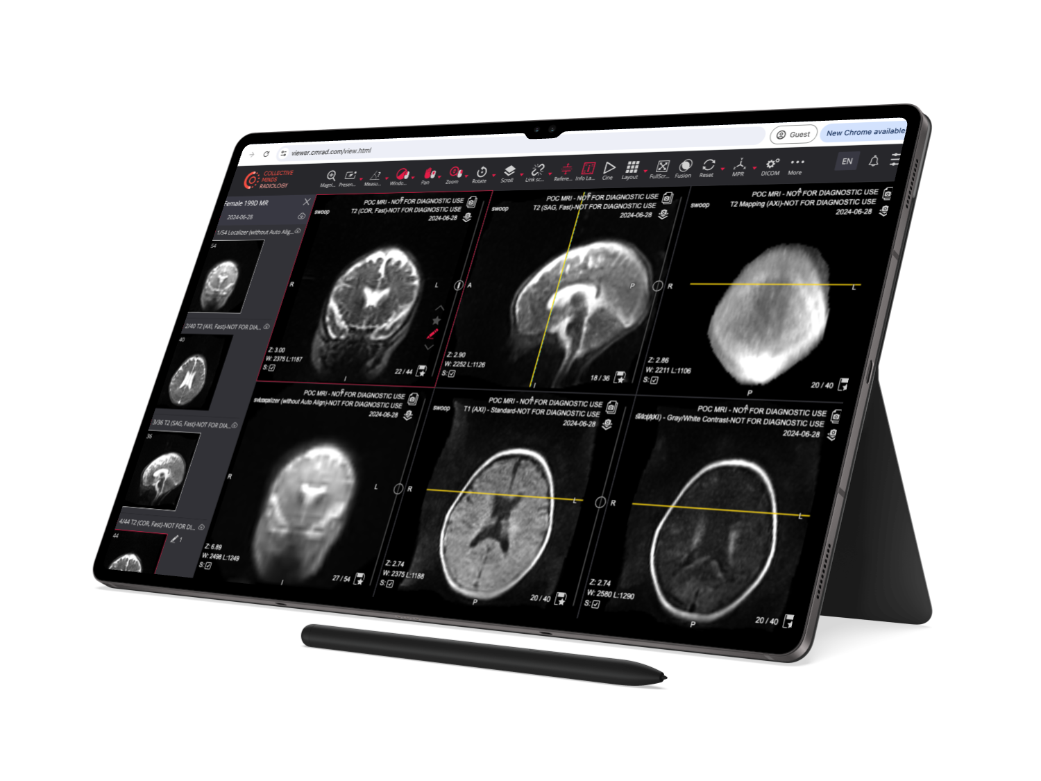 Collective Minds DICOM Viewer on Tablet