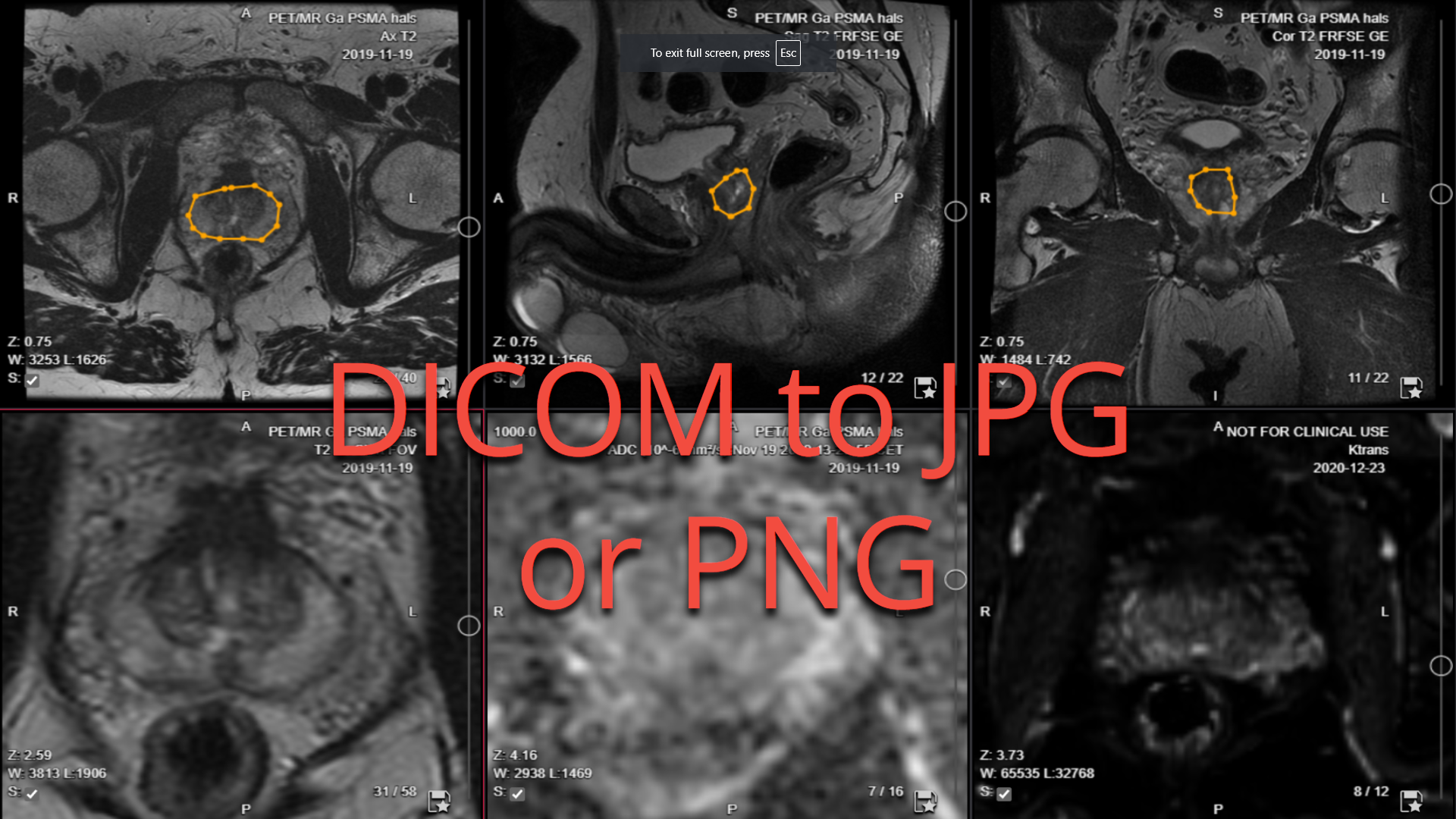 Collective Minds Radiology DICOM to JPG or PNG