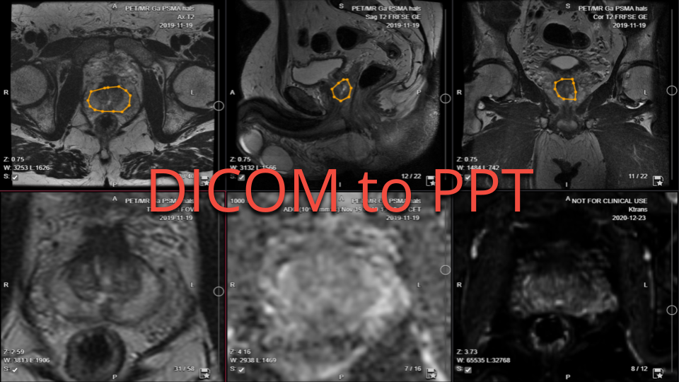 Convert DICOM to PPT