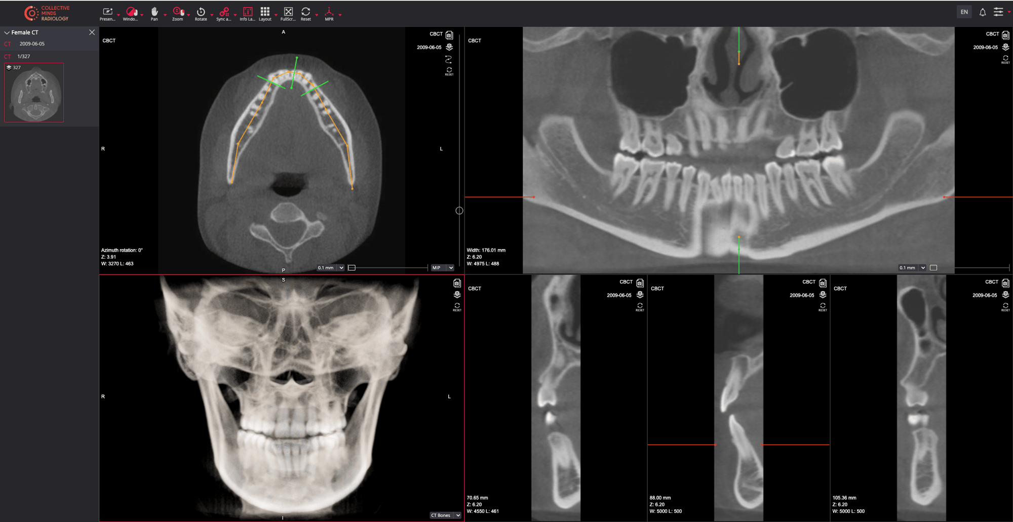 Collective Minds Radiology Dental Cone Beam CT