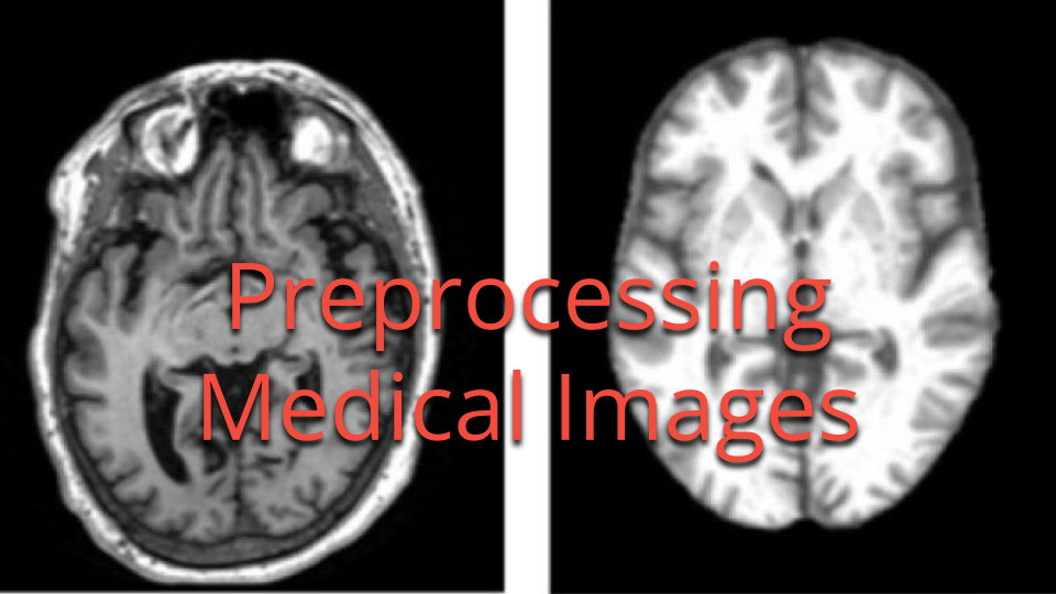 Collective Minds Radiology Preprocessing Medical Images