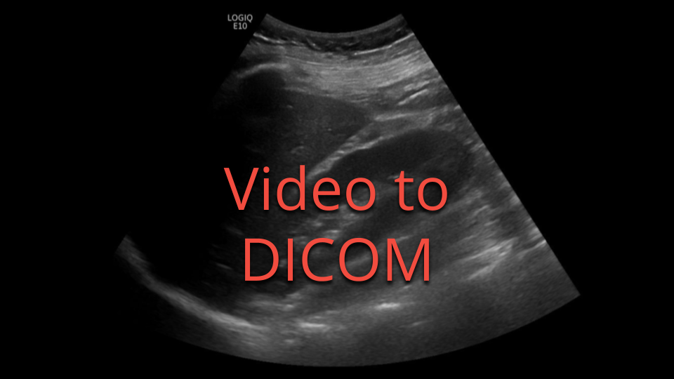 Collective Minds Radiology Video to DICOM