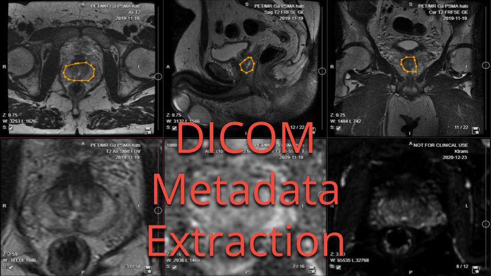 DICOM metadata extraction