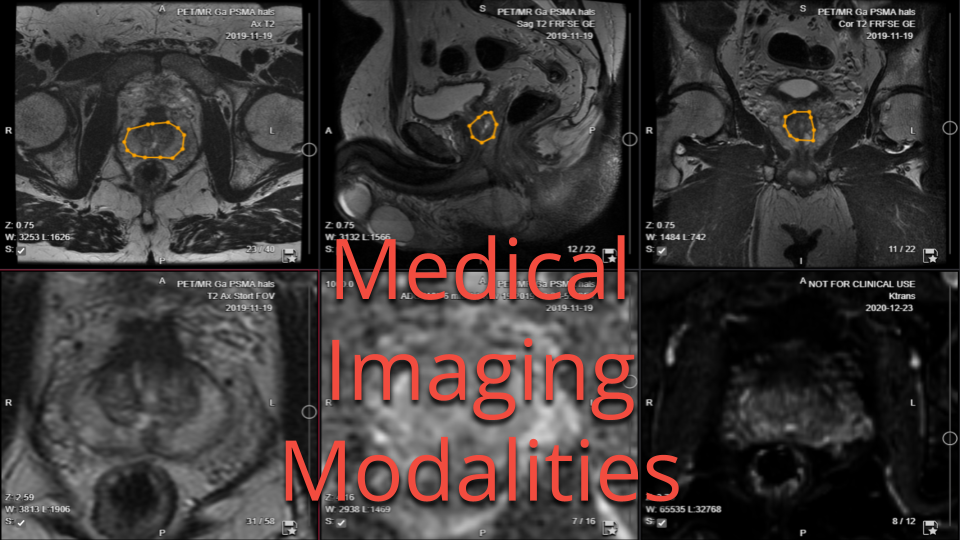 Medical Imaging Modalities