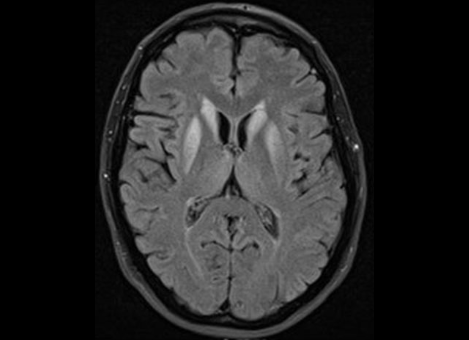 Neurology image