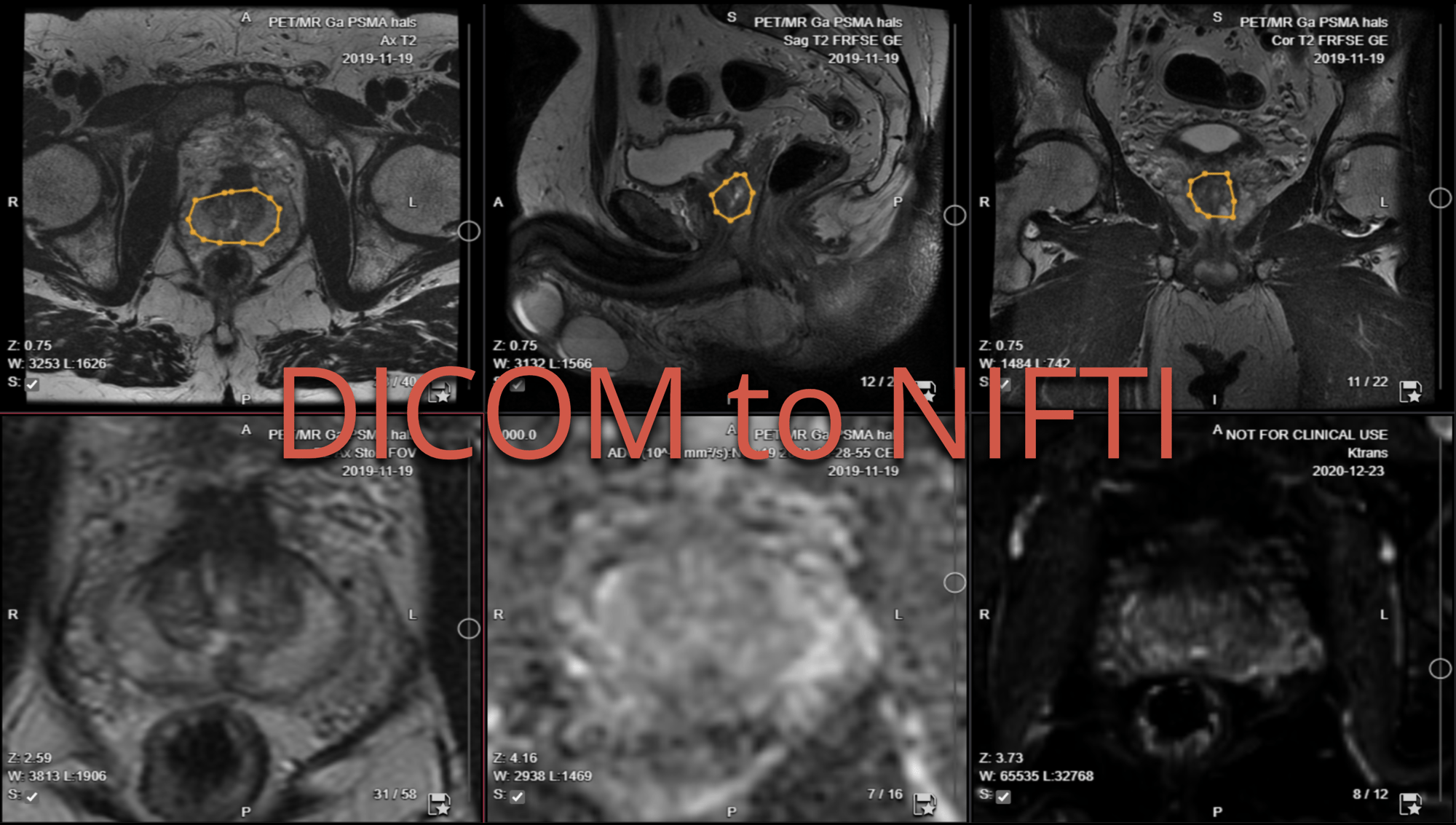 collective minds research segmentation DICOM to NIFTI