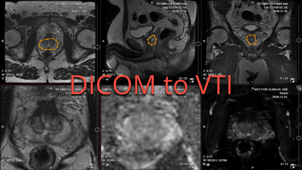 collective minds research segmentation DICOM to VTI